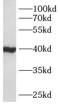 Western Blot: AWAT2 Antibody - BSA Free [NBP3-47904] - Mouse brain tissue were subjected to SDS PAGE followed by western blot with ( AWAT2 Antibody) at dilution of 1:600