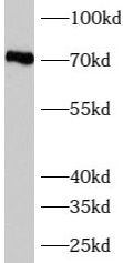 Western Blot: AUTS2 Antibody - BSA Free [NBP3-47905] - C6 cells were subjected to SDS PAGE followed by western blot with (AUTS2 Antibody) at dilution of 1:600