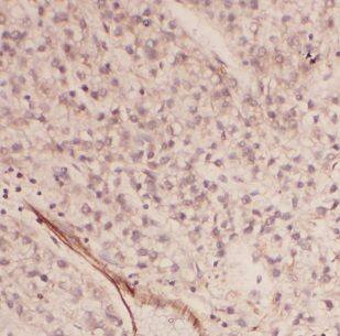 Immunohistochemistry Ancient ubiquitous protein 1 Antibody - BSA Free