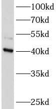 Western Blot ATXN3L Antibody - BSA Free