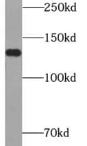 Western Blot Ataxin-2-like protein Antibody - BSA Free