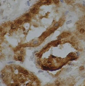 Immunohistochemistry: ATP6V1G3 Antibody - BSA Free [NBP3-47914] - Immunohistochemistry of paraffin-embedded human kidney using (ATP6V1G3 antibody) at dilution of 1:100