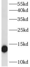 Western Blot: ATP6V1G2 Antibody - BSA Free [NBP3-47915] - Rat brain tissue were subjected to SDS PAGE followed by western blot with (ATP6V1G2 Antibody) at dilution of 1:600