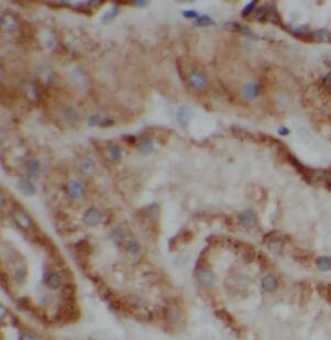 Immunohistochemistry ATP6V1G1 Antibody - BSA Free