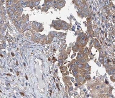 Immunohistochemistry ATP6V1C1 Antibody - BSA Free
