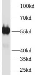 Western Blot: ATP6V1B1 Antibody - BSA Free [NBP3-47918] - Human kidney tissue were subjected to SDS PAGE followed by western blot with (ATP6V1B1 antibody) at dilution of 1:1000