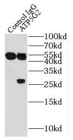 Immunoprecipitation: ATP5G2 Antibody - BSA Free [NBP3-47922] - IP Result of anti-ATP5G2-Specific (IP:, 3ug; Detection: 1:300) with HEK-293 cells lysate 3200ug.
