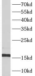 Western Blot: ATP5D Antibody - BSA Free [NBP3-47923] - A549 cells were subjected to SDS PAGE followed by western blot with (ATP5D antibody) at dilution of 1:1000