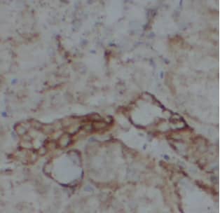 Immunohistochemistry: ATP5D Antibody - BSA Free [NBP3-47923] - Immunohistochemistry of paraffin-embedded human kidney tissue slide using (ATP5D Antibody) at dilution of 1:50