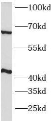 Western Blot: ATPase Na+/K+ beta 2 Antibody - BSA Free [NBP3-47924] - Mouse brain tissue were subjected to SDS PAGE followed by western blot with (ATPase Na+/K+ beta 2 Antibody) at dilution of 1:1000