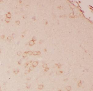 Immunohistochemistry: ATPase Na+/K+ beta 2 Antibody - BSA Free [NBP3-47924] - Immunohistochemistry of paraffin-embedded human brain slide using (ATPase Na+/K+ beta 2 Antibody) at dilution of 1:50