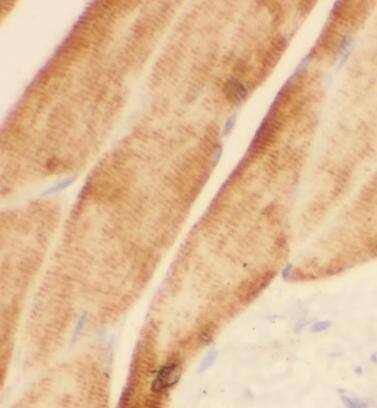 Immunohistochemistry: Sodium Potassium ATPase Alpha 2 Antibody - BSA Free [NBP3-47925] - Immunohistochemistry of paraffin-embedded human skeletal muscle using (Sodium Potassium ATPase Alpha 2 antibody) at dilution of 1:50