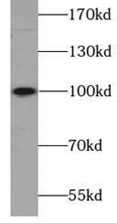 Western Blot: Sodium Potassium ATPase Alpha 2 Antibody - BSA Free [NBP3-47925] - Mouse brain tissue were subjected to SDS PAGE followed by western blot with (Sodium Potassium ATPase Alpha 2 antibody) at dilution of 1:800