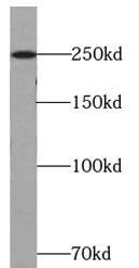 Western Blot: ATG2B Antibody - BSA Free [NBP3-47929] - HeLa cells were subjected to SDS PAGE followed by western blot with (ATG2B Antibody) at dilution of 1:600