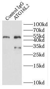 Immunoprecipitation: ATG16L2 Antibody - BSA Free [NBP3-47930] - IP Result of anti-ATG16L2 (IP:, 3ug; Detection: 1:700) with mouse testis tissue lysate 4800ug
