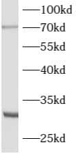 Western Blot: ATG16L2 Antibody - BSA Free [NBP3-47930] - Mouse testis tissue were subjected to SDS PAGE followed by western blot with ( ATG16L2 Antibody) at dilution of 1:1000