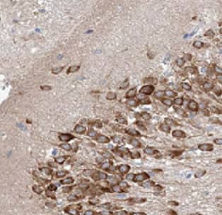 Immunohistochemistry ATF6 beta Antibody - BSA Free