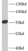 Western Blot ACCN4 Antibody - BSA Free