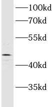 Western Blot: ASCC1 Antibody - BSA Free [NBP3-47937] - Y79 cells were subjected to SDS PAGE followed by western blot with ( ASCC1 Antibody) at dilution of 1:600