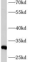 Western Blot: ASB9 Antibody - BSA Free [NBP3-47939] - Human testis tissue were subjected to SDS PAGE followed by western blot with (ASB9 antibody) at dilution of 1:300