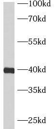 Western Blot ASB5 Antibody - BSA Free