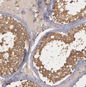 Immunohistochemistry ASB17 Antibody - BSA Free