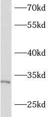Western Blot ASB17 Antibody - BSA Free