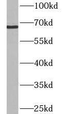 Western Blot: ASB-14 Antibody - BSA Free [NBP3-47942] - Mouse spleen tissue were subjected to SDS PAGE followed by western blot with (ASB-14 Antibody) at dilution of 1:600
