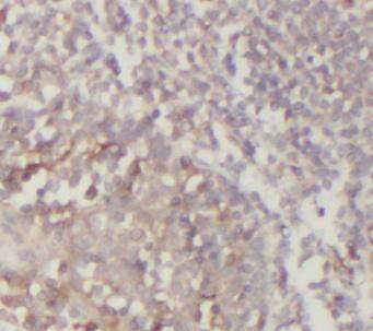 Immunohistochemistry: ASB-14 Antibody - BSA Free [NBP3-47942] - Immunohistochemistry of paraffin-embedded human tonsillitis tissue slide using (ASB-14 Antibody) at dilution of 1:50