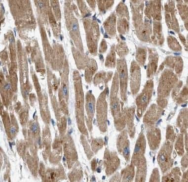 Immunohistochemistry: ASB13 Antibody - BSA Free [NBP3-47943] - Immunohistochemistry of paraffin-embedded human heart tissue slide using (ASB13 Antibody) at dilution of 1:100