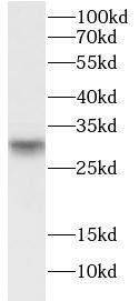 Western Blot: ASB13 Antibody - BSA Free [NBP3-47943] - Mouse heart tissue were subjected to SDS PAGE followed by western blot with (ASB13 Antibody) at dilution of 1:600