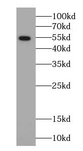 Western Blot ARSK Antibody - BSA Free