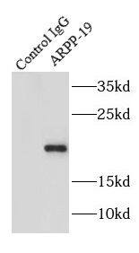 Immunoprecipitation ARPP19 Antibody - BSA Free