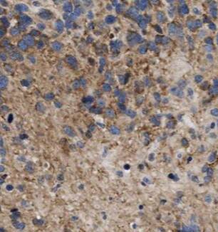 Immunohistochemistry ARPP19 Antibody - BSA Free