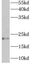 Western Blot: ARMER Antibody - BSA Free [NBP3-47950] - Mouse lung tissue were subjected to SDS PAGE followed by western blot with (ARMER antibody) at dilution of 1:300