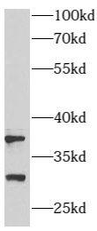 Western Blot: ARMC10 Antibody - BSA Free [NBP3-47956] - A431 cells were subjected to SDS PAGE followed by western blot with (ARMC10 antibody) at dilution of 1:500