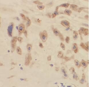 Immunohistochemistry: ARMC10 Antibody - BSA Free [NBP3-47956] - Immunohistochemistry of paraffin-embedded human placenta using (ARMC10 antibody) at dilution of 1:100