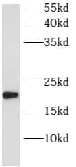 Western Blot: ARL8B Antibody - BSA Free [NBP3-47957] - Fetal human brain tissue were subjected to SDS PAGE followed by western blot with (ARL8B Antibody) at dilution of 1:600