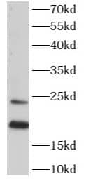 Western Blot: ARL2 Antibody - BSA Free [NBP3-47962] - Mouse liver tissue were subjected to SDS PAGE followed by western blot with (ARL2 antibody) at dilution of 1:500