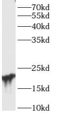 Western Blot ARL15 Antibody - BSA Free