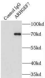 Immunoprecipitation: ARHGEF7 Antibody - BSA Free [NBP3-47965] - IP Result of anti-ARHGEF7 (IP:, 4ug; Detection: 1:1000) with HeLa cells lysate 1200ug.