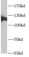 Western Blot: p114RhoGEF Antibody - BSA Free [NBP3-47967] - Mouse testis tissue were subjected to SDS PAGE followed by western blot with (p114RhoGEF antibody) at dilution of 1:300