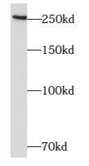 Western Blot: ARHGAP21 Antibody - BSA Free [NBP3-47970] - PC-3 cells were subjected to SDS PAGE followed by western blot with (ARHGAP21 Antibody) at dilution of 1:600