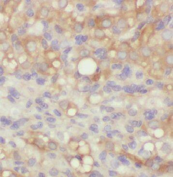 Immunohistochemistry: ARHGAP21 Antibody - BSA Free [NBP3-47970] - Immunohistochemistry of paraffin-embedded human ovary tissue slide using (ARHGAP21 Antibody) at dilution of 1:50