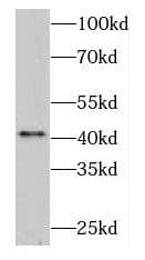 Western Blot: DNASE2B Antibody - BSA Free [NBP3-47976] - Jurkat cells were subjected to SDS PAGE followed by western blot with (DNASE2B Antibody) at dilution of 1:2000