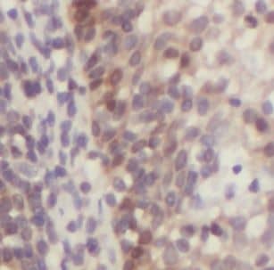 Immunohistochemistry: DNASE2B Antibody - BSA Free [NBP3-47976] - Immunohistochemistry of paraffin-embedded human tonsillitis tissue slide using (DNASE2B Antibody) at dilution of 1:50
