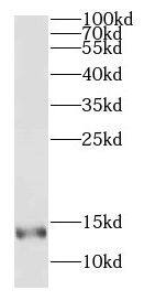 Western Blot: Dynein light chain 4 Antibody - BSA Free [NBP3-47979] - Mouse testis tissue were subjected to SDS PAGE followed by western blot with (Dynein light chain 4 antibody) at dilution of 1:300