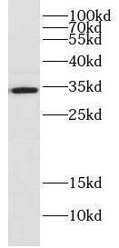 Western Blot: DjC9 Antibody - BSA Free [NBP3-47980] - HeLa cells were subjected to SDS PAGE followed by western blot with ( DjC9 Antibody) at dilution of 1:1000