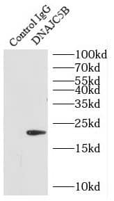 Immunoprecipitation: DNAJC5B Antibody - BSA Free [NBP3-47982] - IP Result of anti-DNAJC5B (IP:, 3ug; Detection: 1:1500) with mouse testis tissue lysate 4000ug.