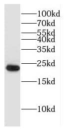 Western Blot: DNAJC5B Antibody - BSA Free [NBP3-47982] - Mouse testis tissue were subjected to SDS PAGE followed by western blot with (DNAJC5B antibody) at dilution of 1:1500